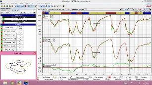 Data Acquisition Install